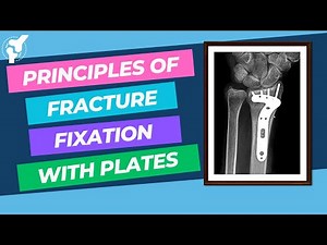 Principles of Fracture Internal Fixation With Plates and Screws | Material Properties
