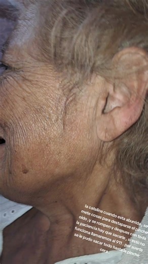 Limpieza de Oído: Catalina y sus Aventuras