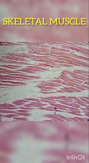 Skeletal muscle under microscope- Histology slide show