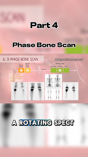 What Do you Know Phase Bone Scan #3danimation #scan #bone #medical #doctor #patient