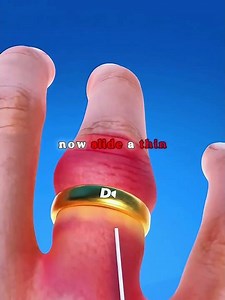Ring Stuck on Your Finger? Try This Trick