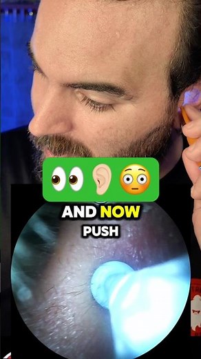 Is That a Blackhead?! 🤯 | 4K Ear Cleaning ASMR 👀👂🏻 #asmr #bebird #