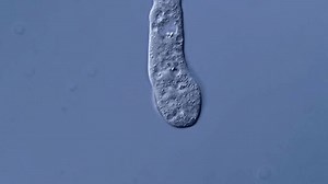 Amoeba Under Dic Microscope View Stock Footage Video (100% Royalty-free) 3789055085 | Shutterstock