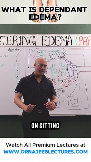 9.3K views · 177 reactions | What is dependant edema? Edema, or swelling, occurs when excess fluid collects in your body's tissues. Dependent edema is specific to parts of the body that that are influenced by gravity, such as your legs, feet, or arms. Edema may be a side effect of medications for conditions such as high blood pressure or diabetes. | Dr. Najeeb | Facebook