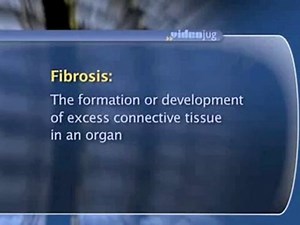 Colorectal Cancer: What To Expect After : What sexual problems are associated with colorectal cancer