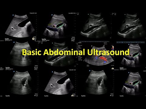 3- Diffuse Liver Pathology US - Amal Fathy