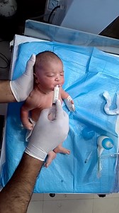 In this video, we demonstrate syringe feeding for a newborn baby in the NICU. Syringe feeding is used when the baby is too weak to breastfeed or bottle-feed. This method helps the baby get safe and gentle nutrition. This video covers: ✔ Correct baby positioning ✔ Step-by-step syringe feeding technique ✔ How to control flow and prevent choking ✔ Care for premature or low-weight babies ✔ Important NICU safety guidelines This video is for educational purposes only. Always follow your hospital’s pro