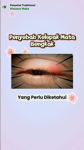 PENYEBAB KELOPAK MATA BENGKAK