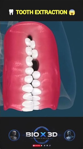 Rotten Tooth Extraction🦷 | Decayed Tooth Removal by Dentist 😱 #shorts #science #dental #tooth #3d