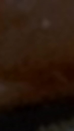 Understanding Low-Resolution Image Issues