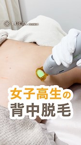 女子高生の背中脱毛に密着💭👀 ＿＿＿＿＿＿＿＿＿＿ ルシアクリニックでは 熱破壊式《ジェントルシリーズ》だけを使用。 効果のある永久脱毛をご提供しています💡 「理想の脱毛」ルシアクリニックで 叶えてみませんか？☺️🌸 無料カウンセリングは プロフィールURLまたは お電話からお気軽にどうぞ🕊️ ＿＿＿＿＿＿＿＿＿＿ #ルシアクリニック #医療脱毛 #医療脱毛クリニック #熱破壊式 #背中脱毛 #高校生脱毛 #脱毛照射 #脱毛レポ | ルシアクリニック【LUCIA CLINIC】