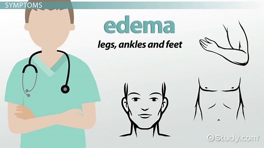 Fluid Volume Excess: Symptoms & Nursing Interventions