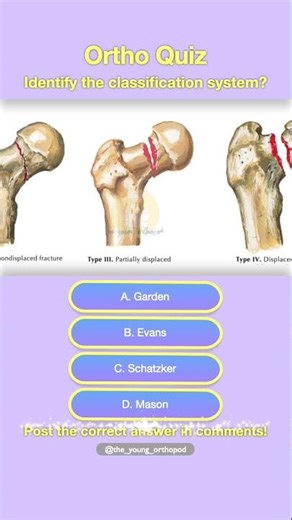 Femur Fracture MCQ 🦴 | #medicalmcq #neetpg #orthopaedics