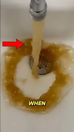 Tap Water Hides Monsters ‼️😱 #Microscope #scienceshorts