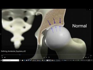 BlenderMeds Bone Cross Section
