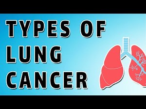 Neuroendocrine Lung Tumors