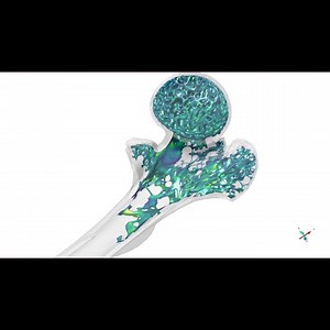 Strong, yet light: a unique view into a complex, hierarchical structure. X-ray imaging is invaluable in skeletal research both for sample characterization and for bone morphometry measurements. The video shows a mouse long bone with trabecular bone segmented. It was imaged using X-ray microscopy (ZEISS Xradia Versa). This reveals insights into bone structure and condition and enables the study of parameters such as trabecular thickness, BV/TV, or cortical to trabecular bone ratio. Sample from th
