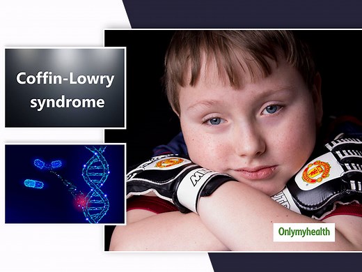 What Is Coffin-Lowry Syndrome (CLS)? Signs, Causes, Diagnosis And Treatment Of This Rare Genetic Disorder