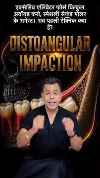 Delhi Dentist shares Angular Impactions Made Easy | Tips & Tricks from 15,000+ Surgeries