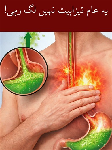 Recognizing GERD Symptoms and Their Impact