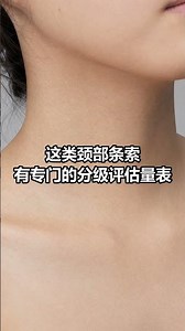 脖子出现这种纹路改善方法 #抗衰老 #颈纹 #健康科普