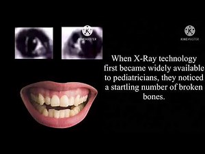 Mr. Incredible becoming uncanny (Disturbing Facts) (50 PHASES)