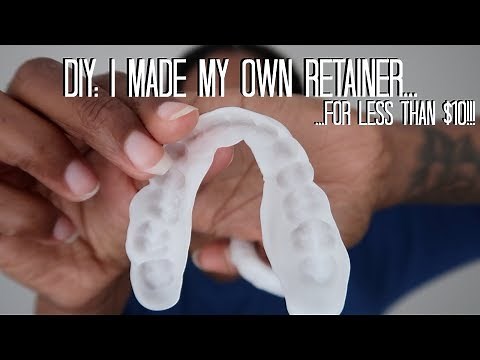 DIY: $10 Retainers! (EASY AF!)