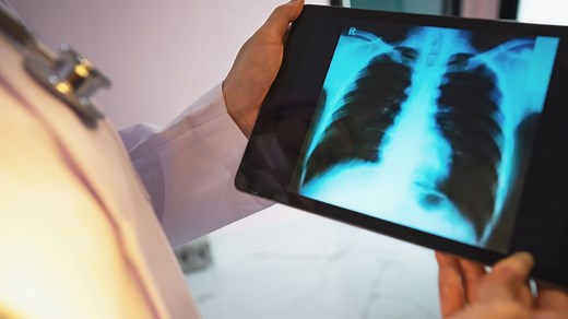 Fracture costale : comment soigner une fracture des côtes ? - RTBF Actus