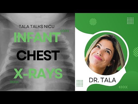 A-B-C-D-Es of reading neonatal Chest X-Rays!!!