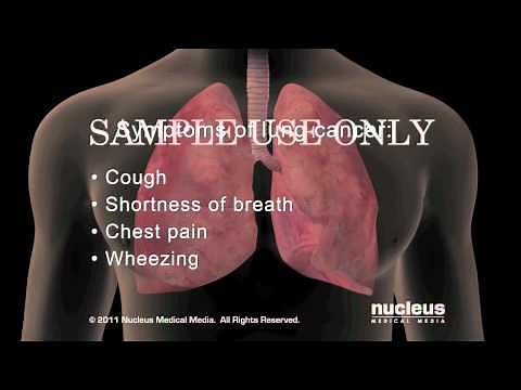 Lung Cancer Symptoms
