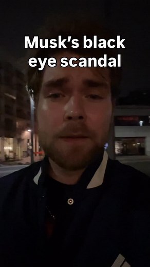 27K views · 545 reactions | ⚡️  ELON MUSK’S BLACK EYE SCANDAL #elonmusk #politics #trump #foxnews #cnn | Ethan Levins | Facebook