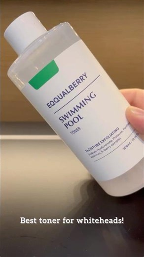 The best toner for whiteheads! 😍
