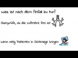 Epileptischer Anfall kurz und knapp erklärt! Mit Symptomen!