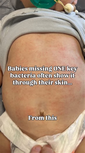 Morgan | Postpartum | Wellness | The bacteria we’re talking about? It’s called bifidobacterium. and it’s supposed to be one of the very first microbes babies get to help... | Instagram