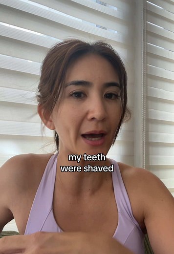 Understanding the Veneer Teeth Process