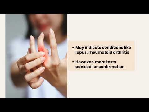 ANA by Immunofluorescence Assay (IFA)