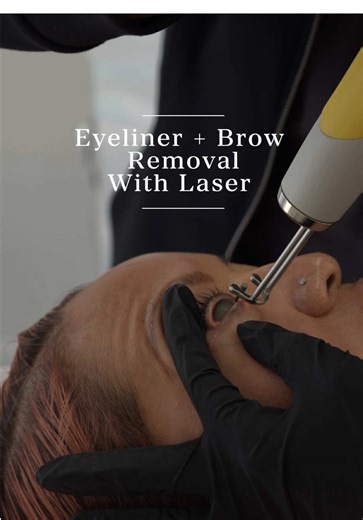 Eyeliner removal is one of the most delicate procedures we perform. This area requires precision, control, and experience. It’s not about being aggressive. It’s about treating the skin correctly, session by session. #eyeliner #brows #delineado #cejas #fypシ