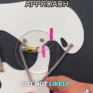 473K views · 5.8K reactions | TMJ Explained #Dentistry #LearningTips #BitesnBraces | Bites & Braces Dental | Facebook