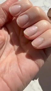 These innovative, easy-to-use, adhesive patches transform damaged nails into healthy-looking nails, so you can feel confident bearing your natural nails. #NailRescue | Kerasal