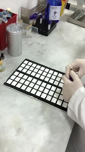 Mission Failed ❌❌ #Blood #group #bloodgroup #bloodbank #donation #donor #blood #labtest #bloodtyping #phlebotomy #laboratory #fyp #CBC #tubes #medicallaboratorytechnician #explorepage✨ #labteam #missionfailed #fail #error