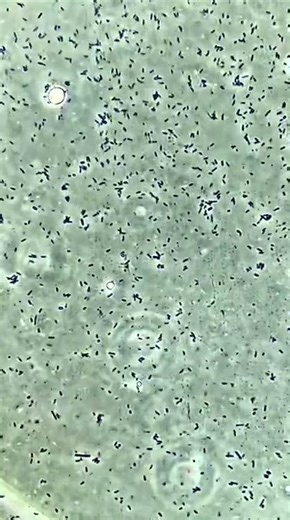Bacteria versus caustic soda under the microscope!