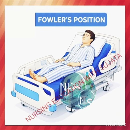 FOWLER'S POSITION ; # Various Positions