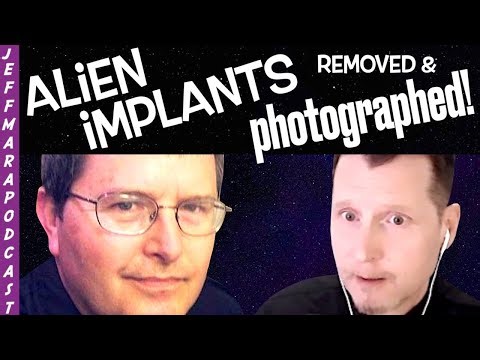 Scientist Has Alien Implant Removed - PHOTOS of Implant & More!