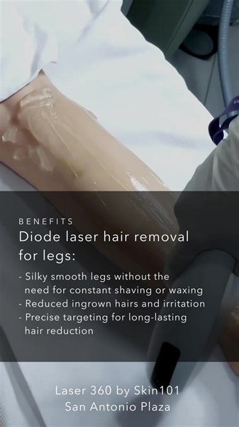 @kallyaraneta “2024 is all about taking my skincare to the next level! Starting strong with Skin101 Day to prep for the year ahead. Check out the benefits of revlite underarms: - Smooth, flawless underarm skin - Reduced pigmentation and discoloration - Minimized appearance of hair follicles - Enhanced confidence in sleeveless outfits And diode laser hair removal for legs: - Silky smooth legs without the need for constant shaving or waxing - Reduced ingrown hairs and irritation - Precise targetin