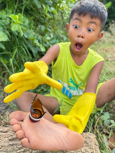 Essential Survival Skills for the Forest