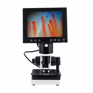 [Hot Item] Capillary Microscope Body Health Test Machine Microcirculation Microscope