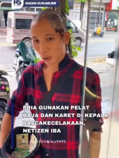Sebuah unggahan di media sosial mendadak viral dan memicu rasa prihatin warganet secara luas di vietnam. Seorang pria dilaporkan terpaksa menggunakan pelat baja yang dilapisi karet pada bagian kepalanya akibat cedera parah setelah mengalami kecelakaan serius. Tindakan nekat ini diduga dilakukan sebagai alternatif pengganti bagian tengkorak kepala yang rusak. Meski memicu simpati, penggunaan material non-medis secara mandiri pada area vital seperti kepala sangat berisiko memicu infeksi berat, iri