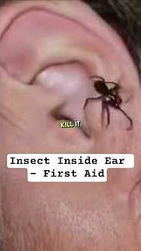 Insect Inside Ear | First Aid | Simple steps to handle it