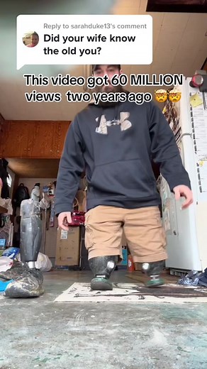 Limb Loss Boss: A Love Story of Overcoming Challenges