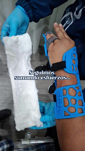 Férula 3D termotransformable para emergencias en Venezuela